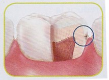 Caries Mallorcadent